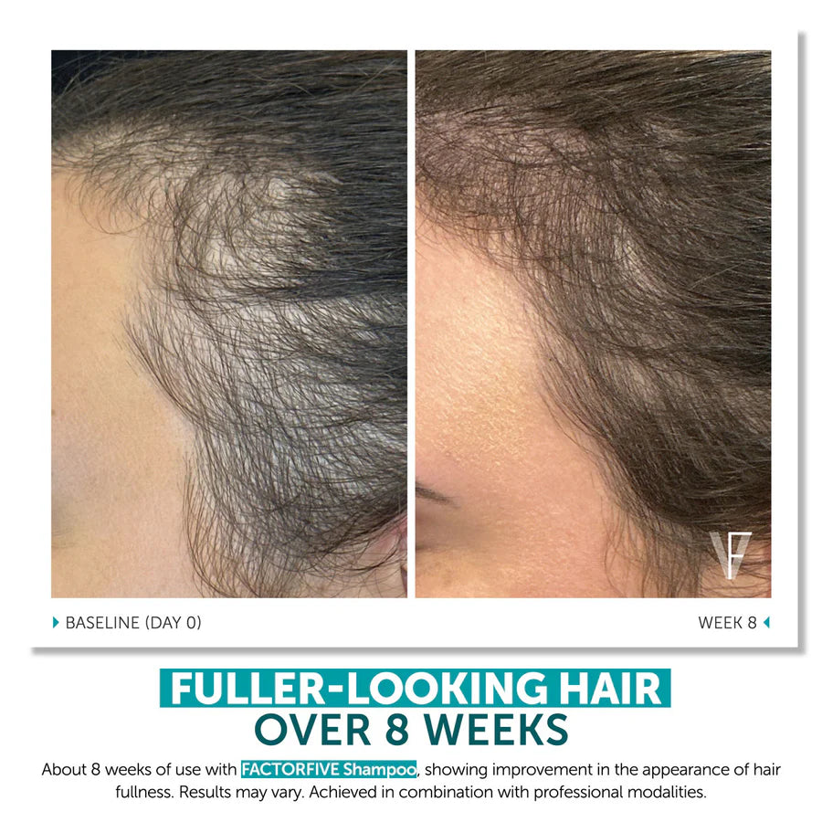 FactorFive Shampoo Advanced Haircare System