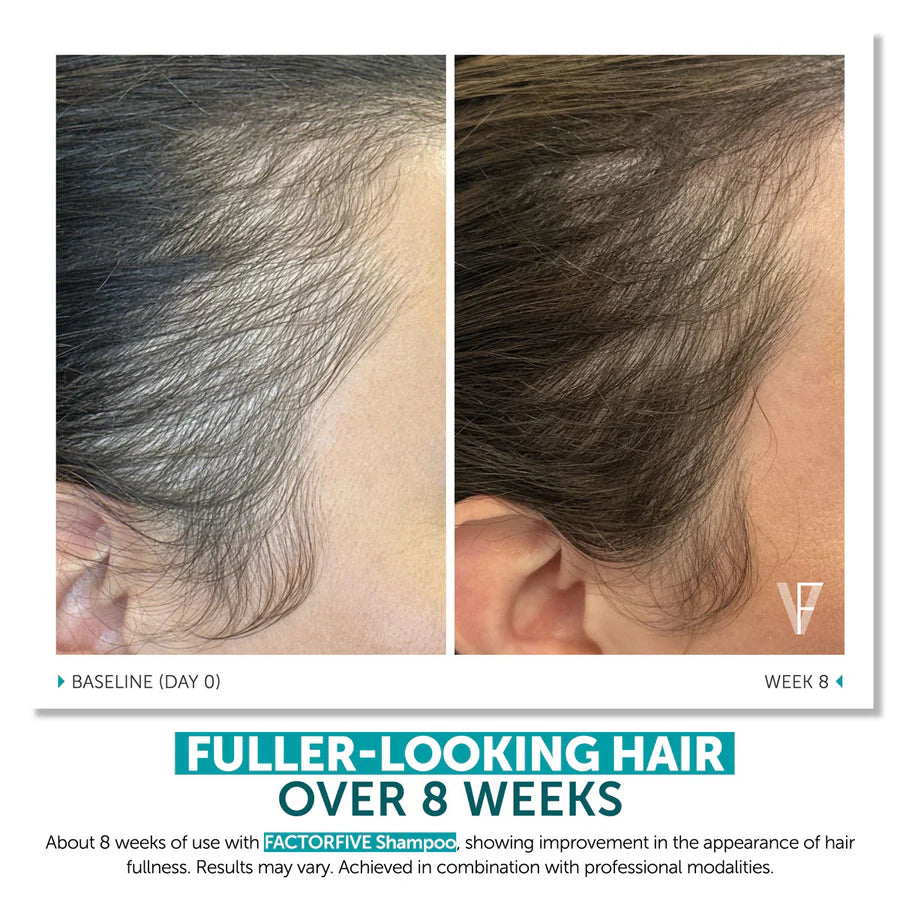 FactorFive Shampoo Advanced Haircare System