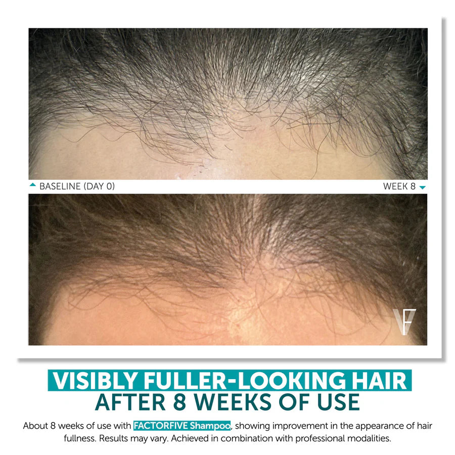 FactorFive Shampoo Advanced Haircare System